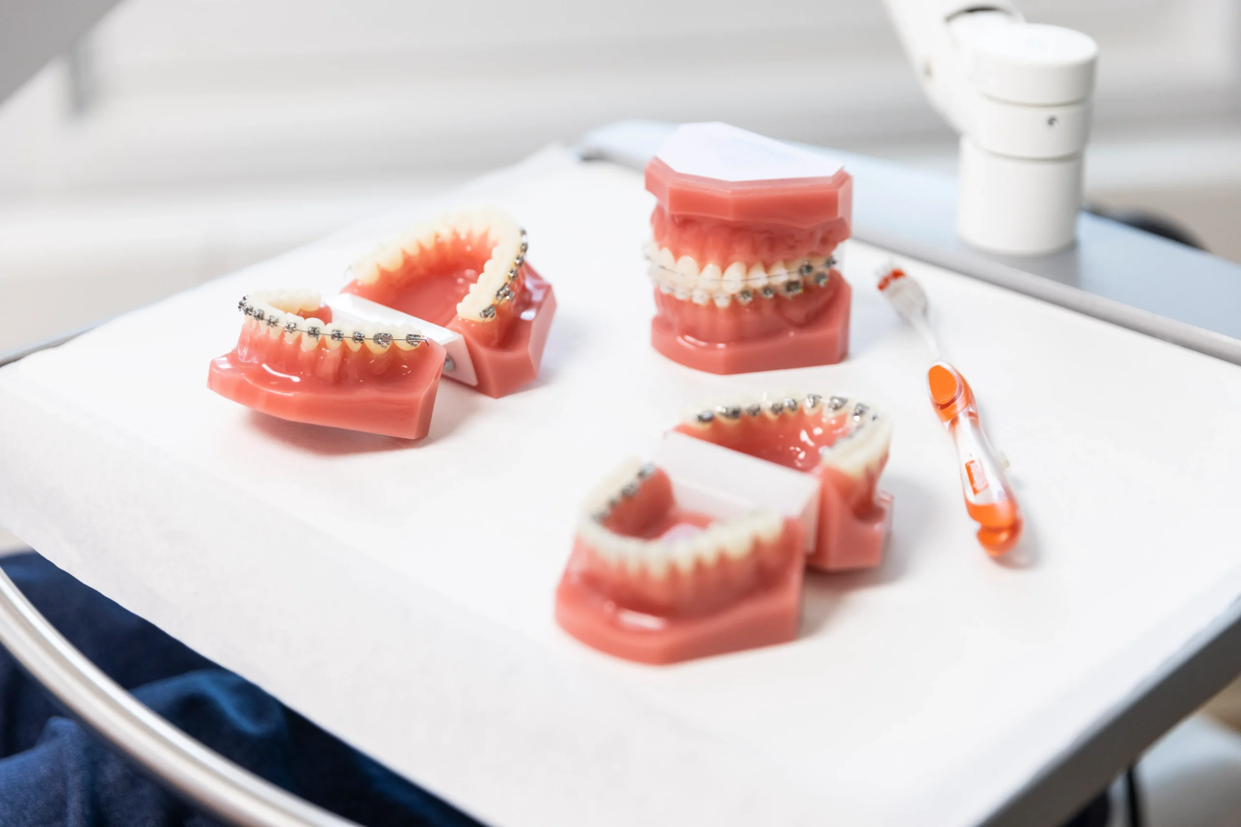 exakte Bracketpositionierung mittels indirektem Kleben