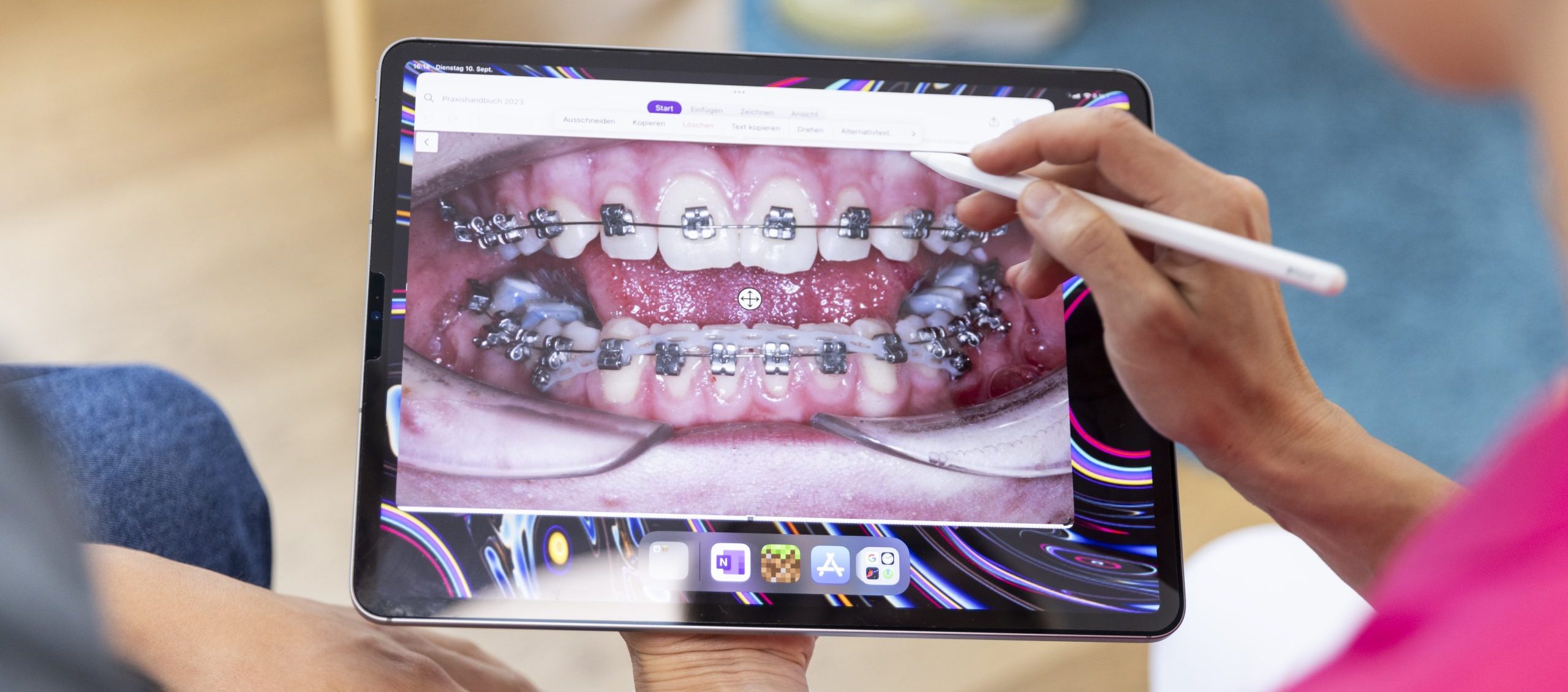 Instruktion Mundhygiene zur Vermeidung von Entkalkungsflecken