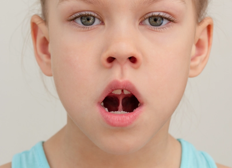 Verkürztes Zungenband?