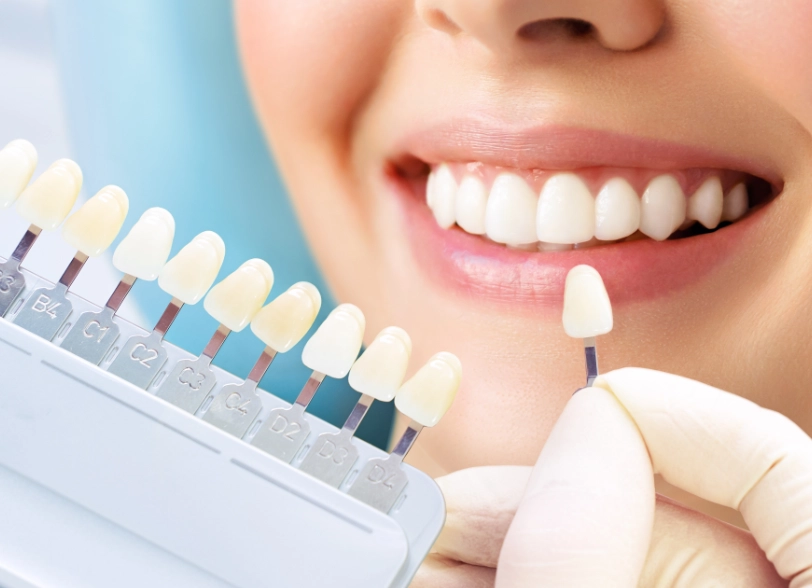 Teeth Whitening Munich South